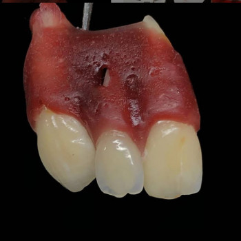 Олександр Григор'єв , Черновцы Фото - 5