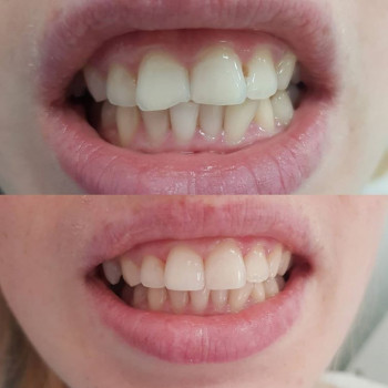 Тетяна Мунтьян , Черновцы Фото - 5