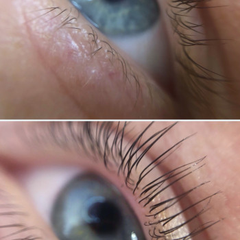 Уход за каждой ресничкой