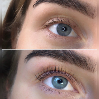 Трендовая процедура нашего времени. Ваш взгляд станет более 