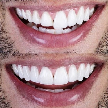 Арман Амбарданян , Одесса Фото - 5