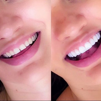 Арман Амбарданян , Одесса Фото - 7