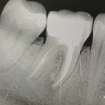 Ігор Киселиця , Чернівці Фото - 5