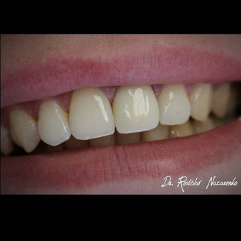 Ростислав Назаренко , Одесса Фото - 5