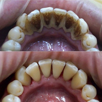 Георгий Якименко , Одесса Фото - 5