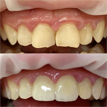 Георгий Якименко , Одесса Фото - 6