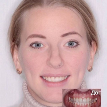 Борис Свинцицкий , Одесса Фото - 5