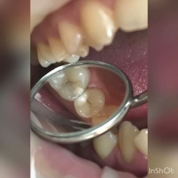 Юлианна Кирилюк , Одесса Фото - 5