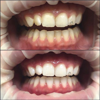 Олег Горячко , Одеса Фото - 5