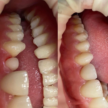 Олег Горячко , Одеса Фото - 6