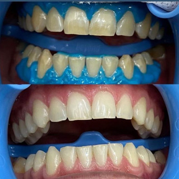 Сергей Розломий , Одеса Фото - 5