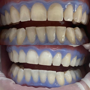 Дмитрий Иванов , Одеса Фото - 7