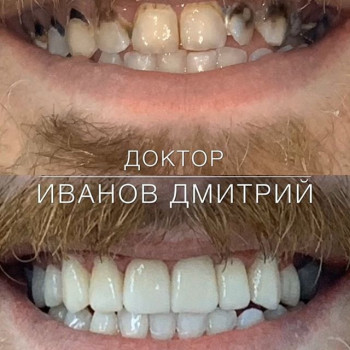 Дмитрий Иванов , Одеса Фото - 8