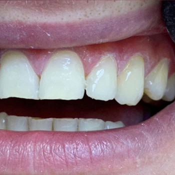 Олена Туровська , Львов Фото - 5