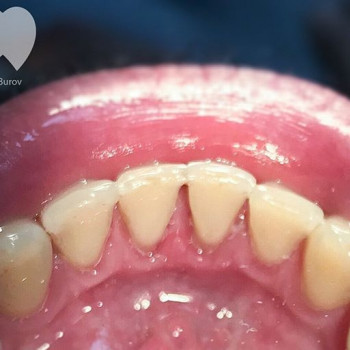 Никита Буров , Одесса Фото - 6