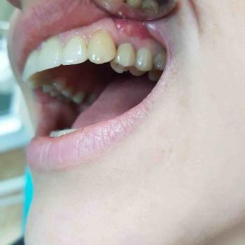 Олег Блохин , Харьков Фото - 7