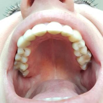 Олег Блохин , Харьков Фото - 3