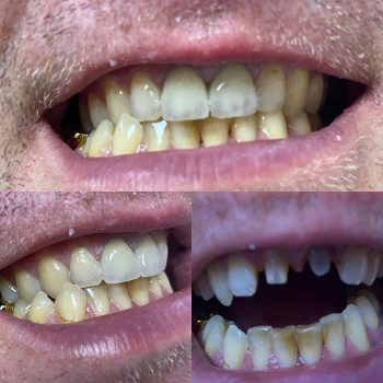 Георгий Бобков , Харків Фото - 5