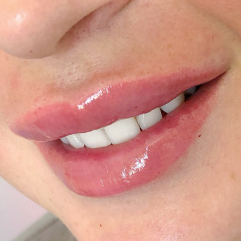 Наталия Кравчук , Харьков Фото - 5