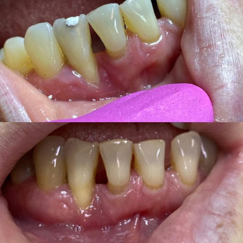 Ольга Ворончук , Черкассы Фото - 5