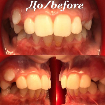 Любовь Власенко , Черкассы Фото - 6