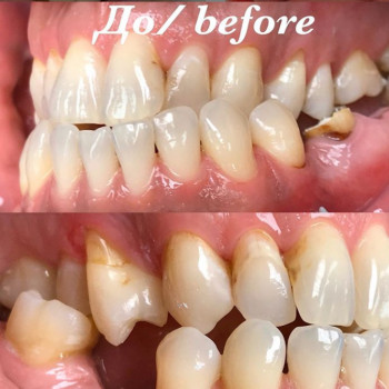 Любовь Власенко , Черкассы Фото - 7