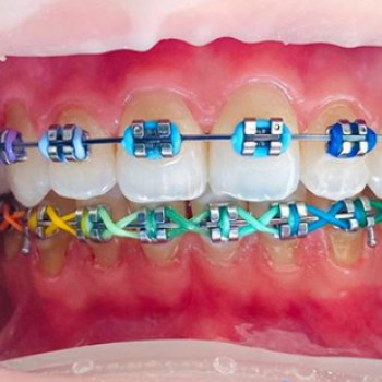 Ірина Ковіта , Черкаси Фото - 5