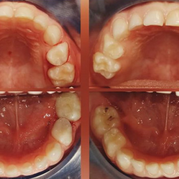 Ліна Чорнобривець , Черкаси Фото - 5
