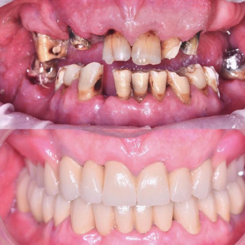 Сергій Кошелюк , Черкассы Фото - 5