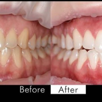 Володимир Терещук , Хмельницький Фото - 5