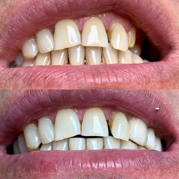 Андрій Стороженко , Хмельницький Фото - 5