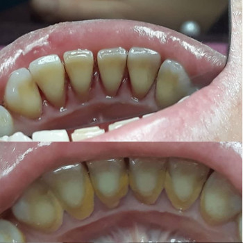 Анна Дриженко , Хмельницкий Фото - 5