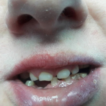 Дмитро Русецький , Херсон Фото - 5