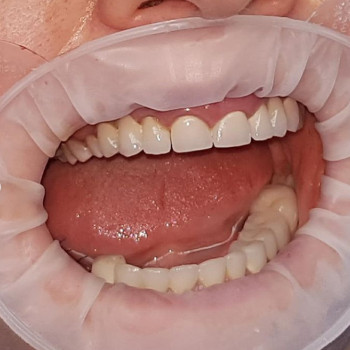 Дмитро Русецький , Херсон Фото - 6