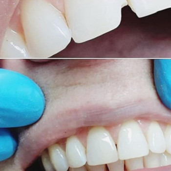 Алла Витюкова , Херсон Фото - 5