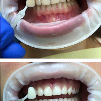 Даниил Морозов , Херсон Фото - 5