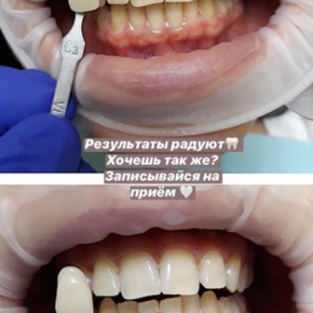 Даниил Морозов , Херсон Фото - 6