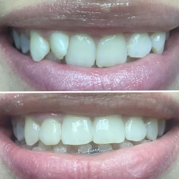 Инна Даниленко , Днепр Фото - 5