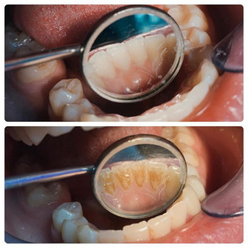 Анатолий Василенко , Дніпро Фото - 5