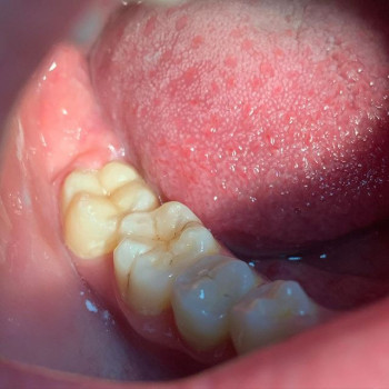 Анатолий Василенко , Дніпро Фото - 6