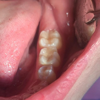 Анатолий Василенко , Дніпро Фото - 7