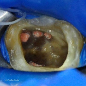 Руслан Кусик , Дніпро Фото - 5