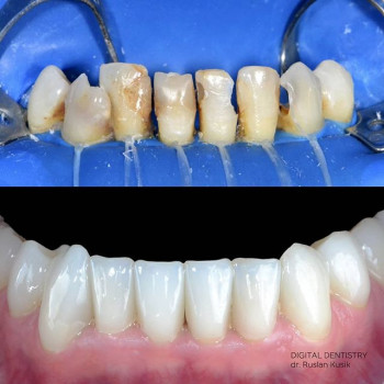 Руслан Кусик , Дніпро Фото - 6