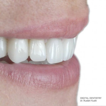 Руслан Кусик , Дніпро Фото - 7