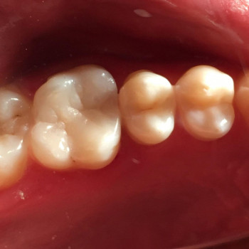 Артем Малихін , Чернівці Фото - 5