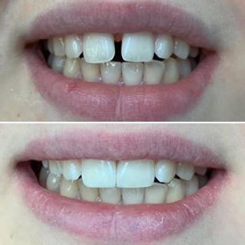 Альбина Титкова , Днепр Фото - 5