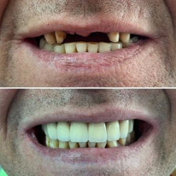 Альбина Титкова , Днепр Фото - 6