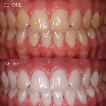 Леся Рудейко , Львов Фото - 5