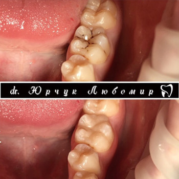 Любомир Юрчук , Львов Фото - 5