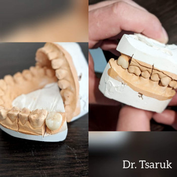 Андрій Царук , Львов Фото - 6